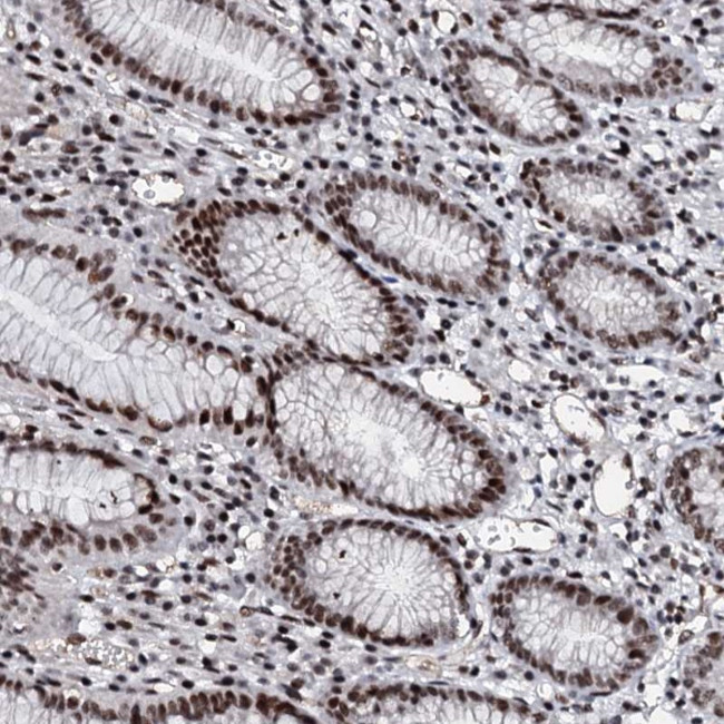 METTL12 Antibody in Immunohistochemistry (Paraffin) (IHC (P))