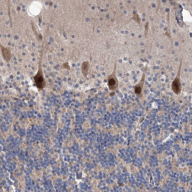PPP2R2B Antibody in Immunohistochemistry (Paraffin) (IHC (P))