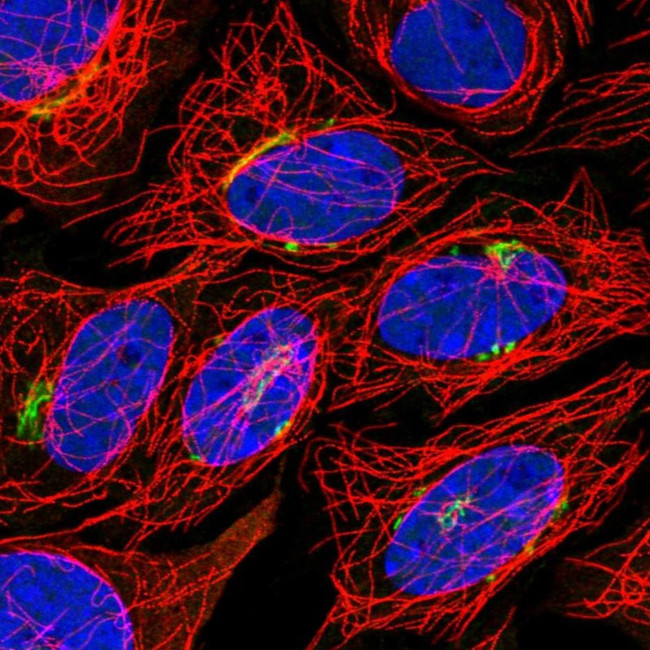 TSHZ2 Antibody in Immunocytochemistry (ICC/IF)