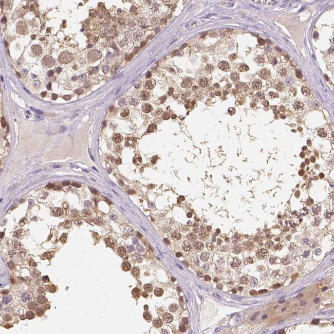 C10orf67 Antibody in Immunohistochemistry (Paraffin) (IHC (P))