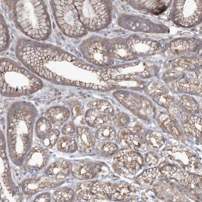 SH3TC1 Antibody in Immunohistochemistry (Paraffin) (IHC (P))