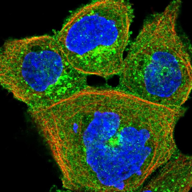 HIP1R Antibody in Immunocytochemistry (ICC/IF)