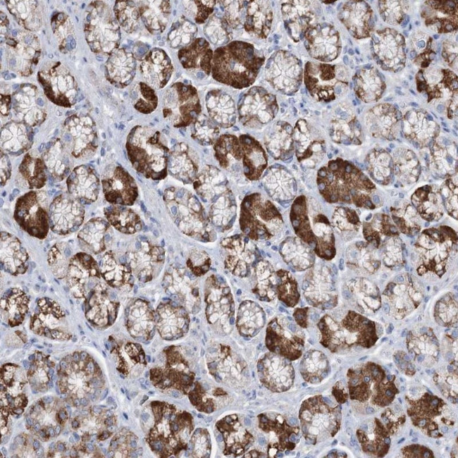 TRIM71 Antibody in Immunohistochemistry (Paraffin) (IHC (P))