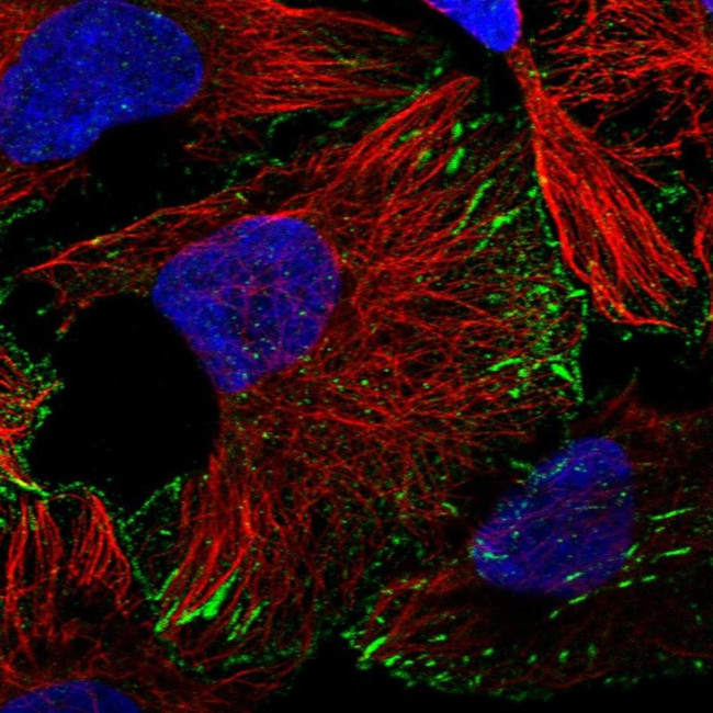 TRIM71 Antibody in Immunocytochemistry (ICC/IF)