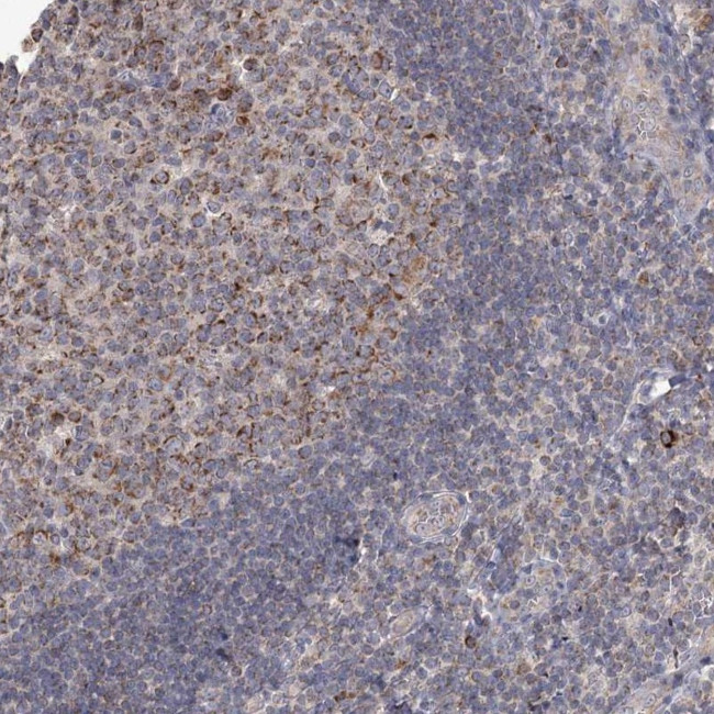 MRPL44 Antibody in Immunohistochemistry (Paraffin) (IHC (P))