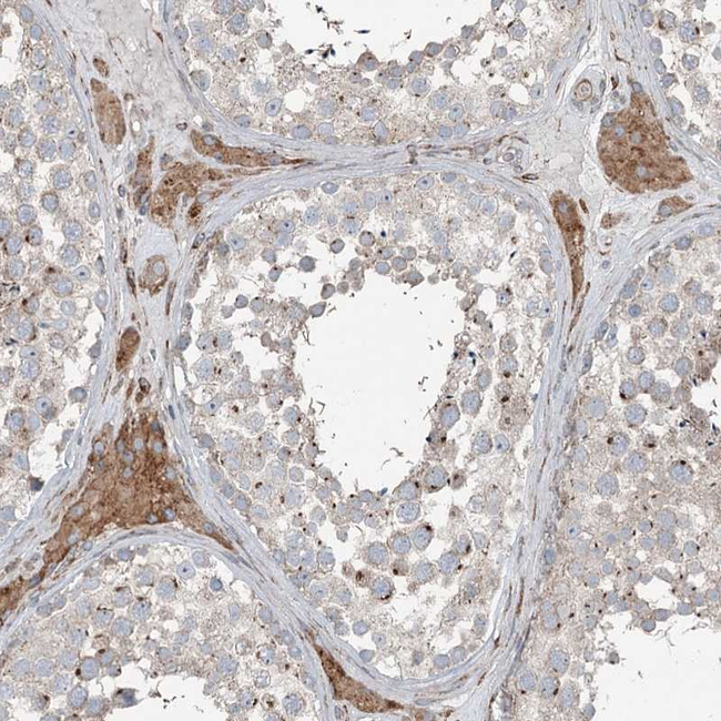 RASSF8 Antibody in Immunohistochemistry (Paraffin) (IHC (P))