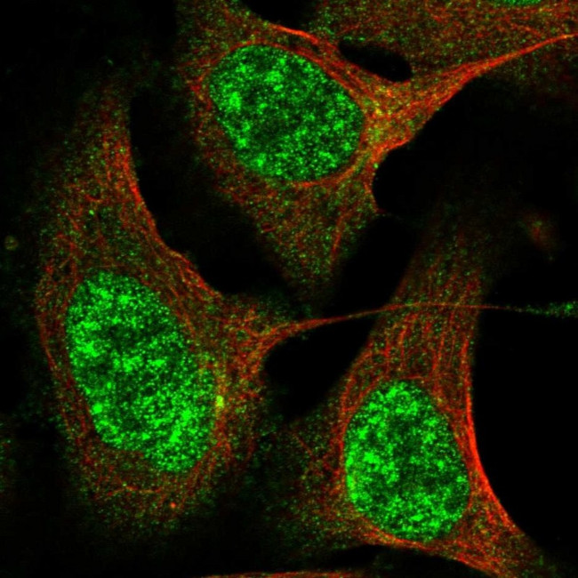 CWF19L2 Antibody in Immunocytochemistry (ICC/IF)