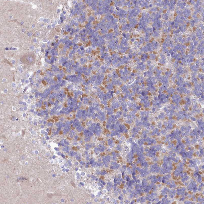 VPS26B Antibody in Immunohistochemistry (Paraffin) (IHC (P))