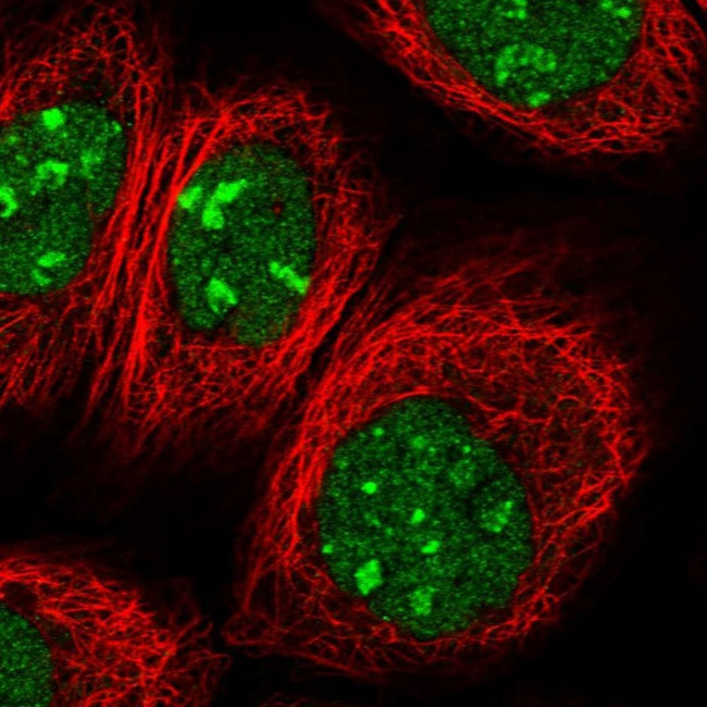 PTMS Antibody in Immunocytochemistry (ICC/IF)