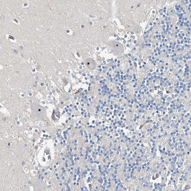 RBM43 Antibody in Immunohistochemistry (Paraffin) (IHC (P))