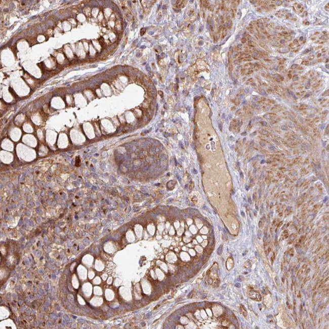SIK1 Antibody in Immunohistochemistry (Paraffin) (IHC (P))