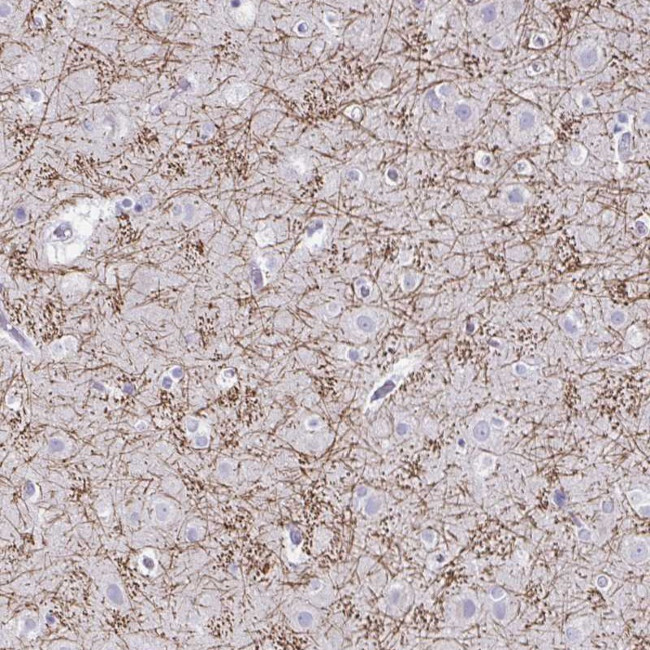CREG2 Antibody in Immunohistochemistry (Paraffin) (IHC (P))
