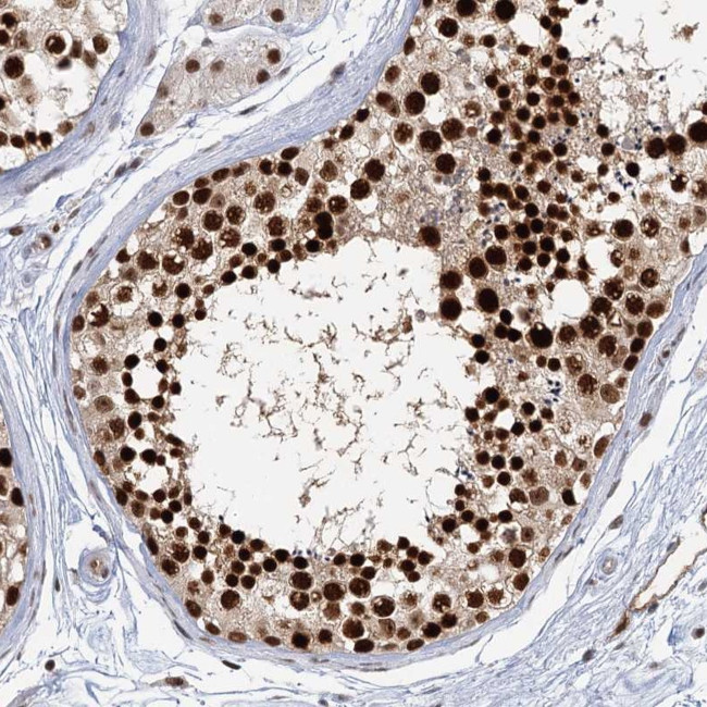 GPATCH11 Antibody in Immunohistochemistry (Paraffin) (IHC (P))