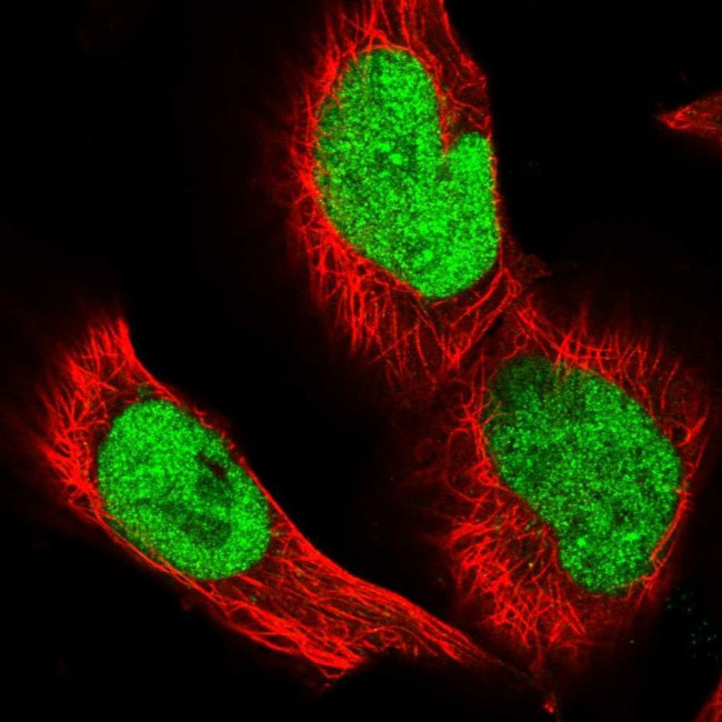GPATCH11 Antibody in Immunocytochemistry (ICC/IF)