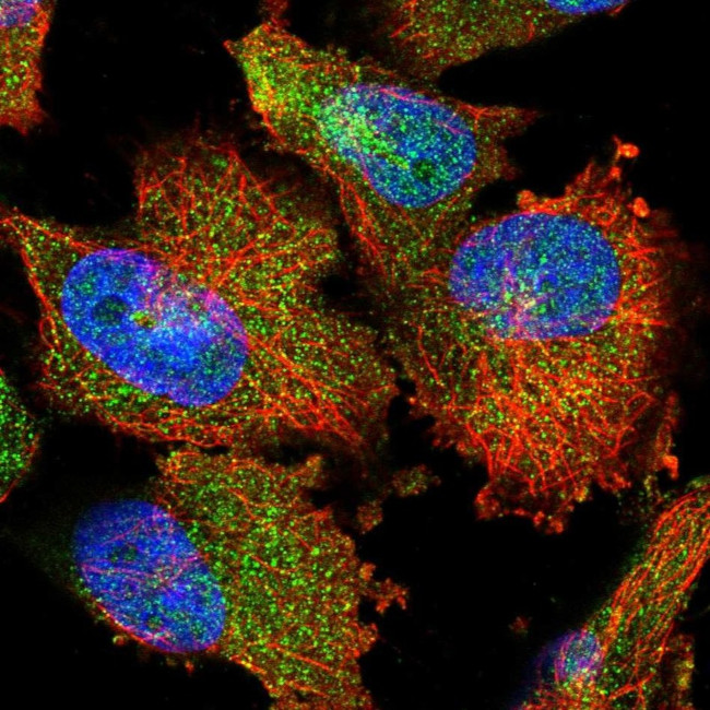 PARM1 Antibody in Immunocytochemistry (ICC/IF)