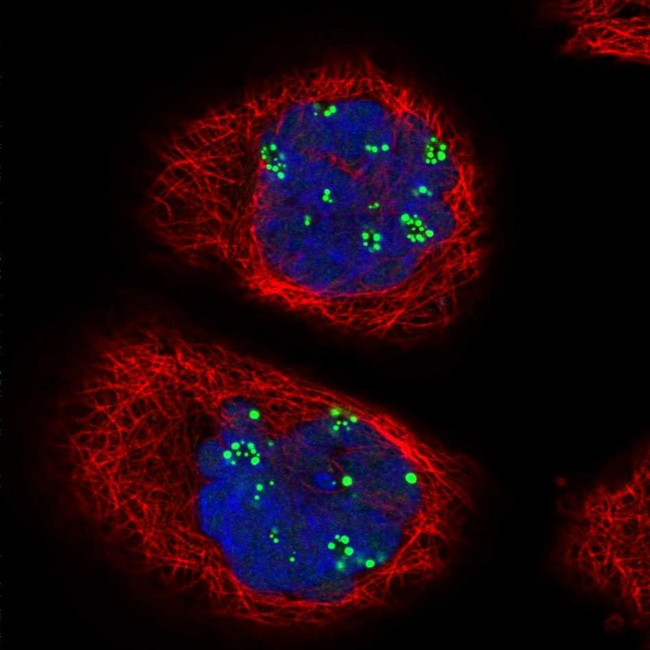 TCOF1 Antibody in Immunocytochemistry (ICC/IF)