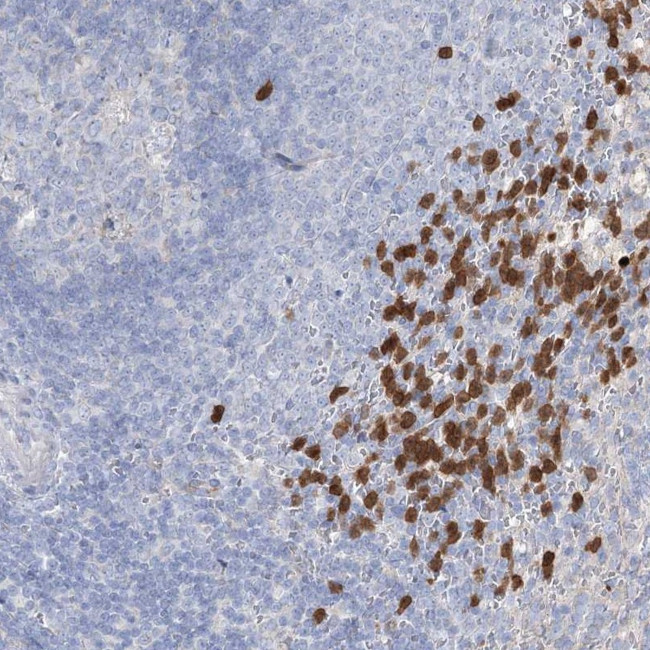 NIPA4 Antibody in Immunohistochemistry (Paraffin) (IHC (P))