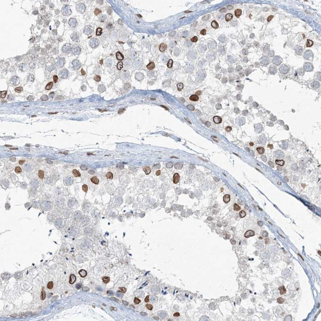 Connexin 40.1 Antibody in Immunohistochemistry (Paraffin) (IHC (P))