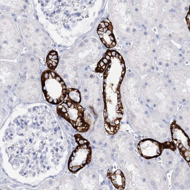 SLC17A2 Antibody in Immunohistochemistry (Paraffin) (IHC (P))