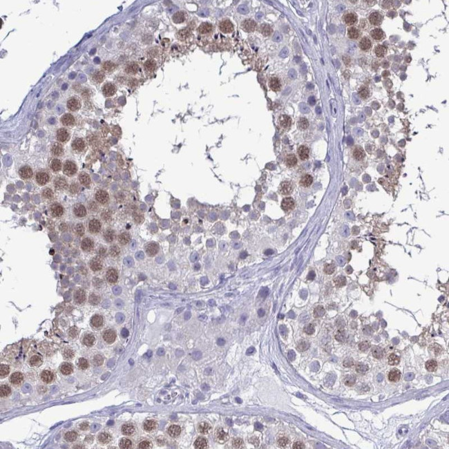 TEX12 Antibody in Immunohistochemistry (Paraffin) (IHC (P))