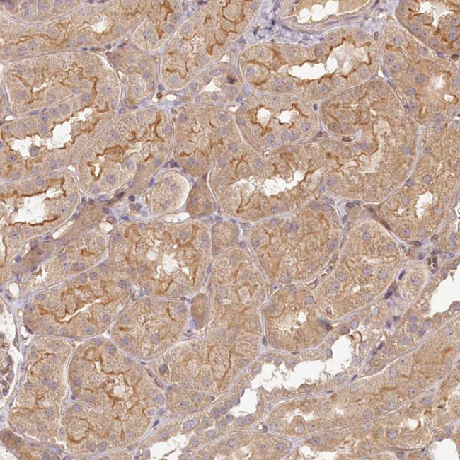 TMIE Antibody in Immunohistochemistry (Paraffin) (IHC (P))