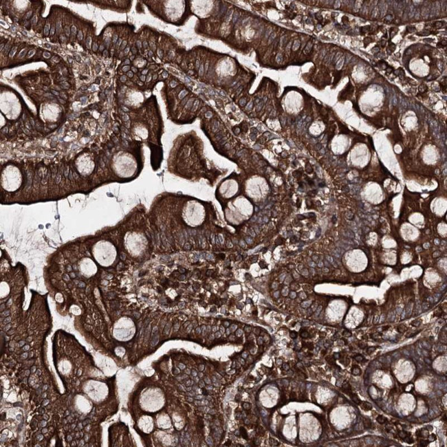 FGFR1OP2 Antibody in Immunohistochemistry (Paraffin) (IHC (P))