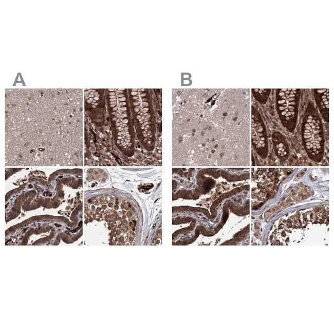 RPAP3 Antibody in Immunohistochemistry (IHC)