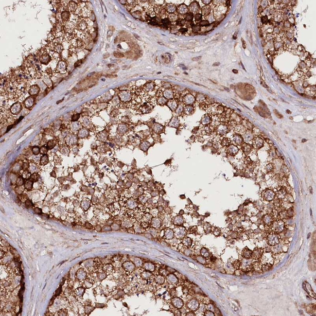 DHX29 Antibody in Immunohistochemistry (Paraffin) (IHC (P))