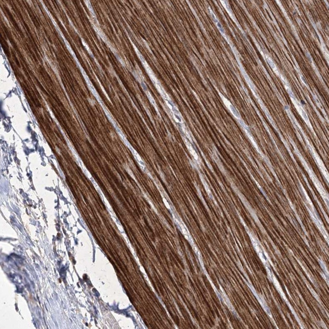 CCDC53 Antibody in Immunohistochemistry (Paraffin) (IHC (P))