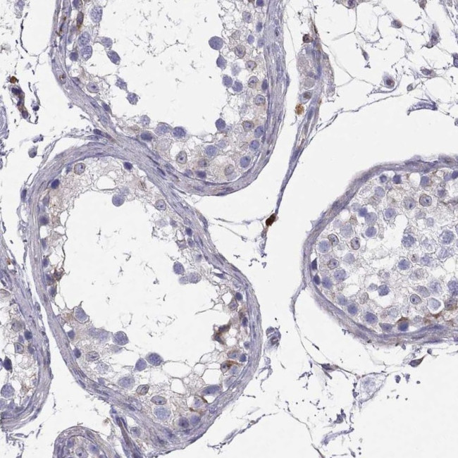 ENOX1 Antibody in Immunohistochemistry (IHC)