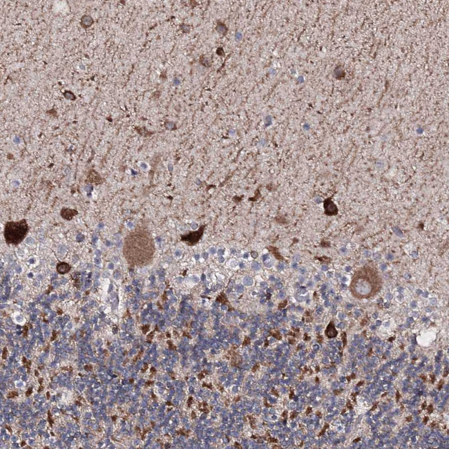 SEMA4G Antibody in Immunohistochemistry (Paraffin) (IHC (P))