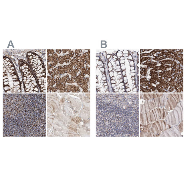 C5orf33 Antibody in Immunohistochemistry (IHC)