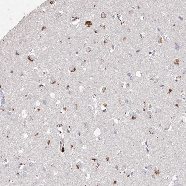 ARSI Antibody in Immunohistochemistry (Paraffin) (IHC (P))