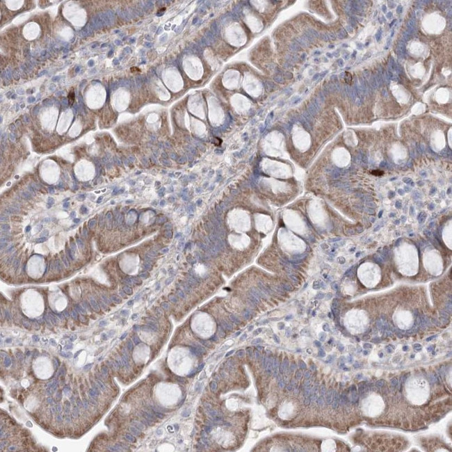 MTCH2 Antibody in Immunohistochemistry (Paraffin) (IHC (P))
