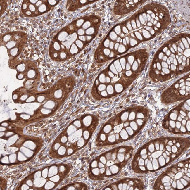 APC4 Antibody in Immunohistochemistry (Paraffin) (IHC (P))
