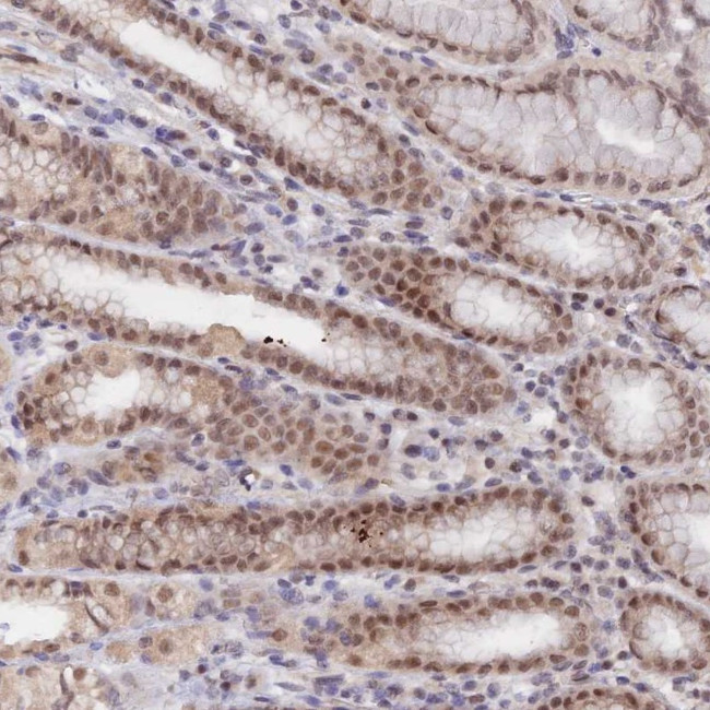APC4 Antibody in Immunohistochemistry (Paraffin) (IHC (P))