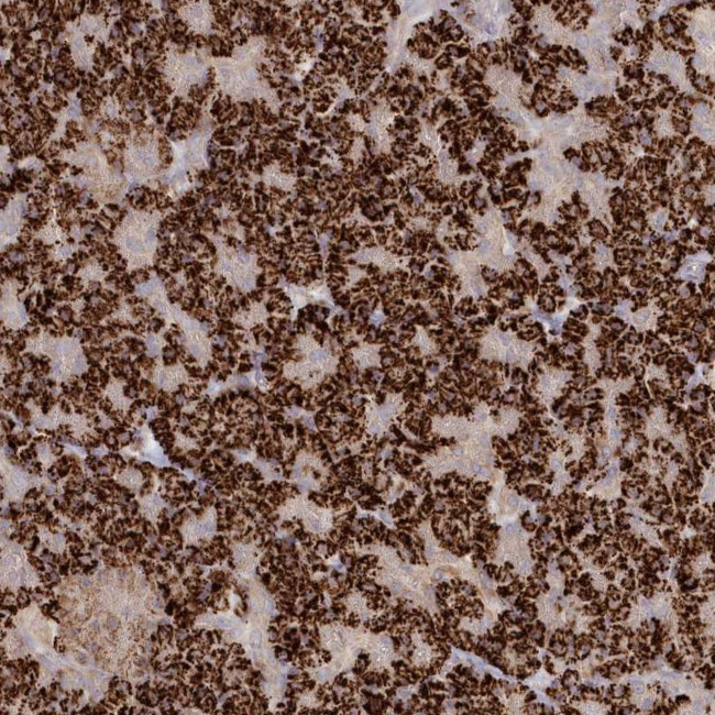 TGFBRAP1 Antibody in Immunohistochemistry (Paraffin) (IHC (P))