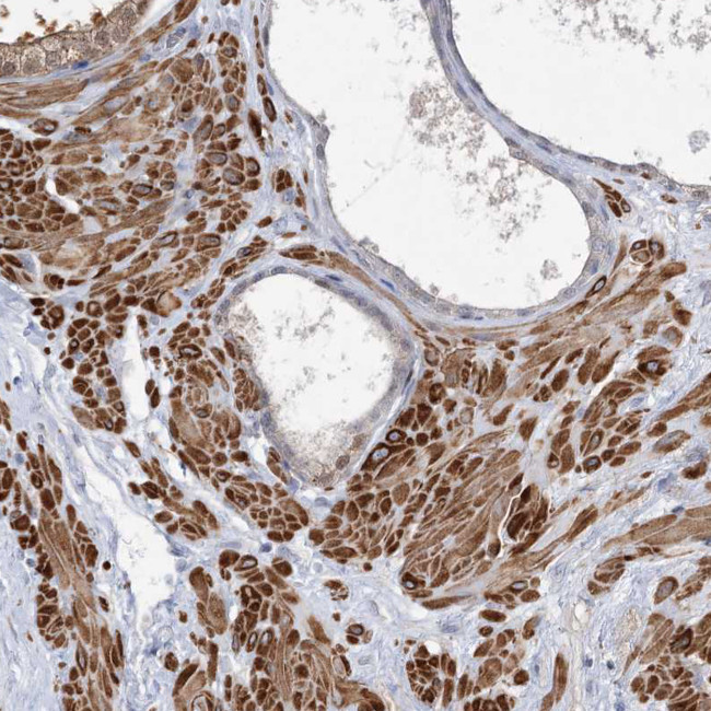ARSI Antibody in Immunohistochemistry (Paraffin) (IHC (P))