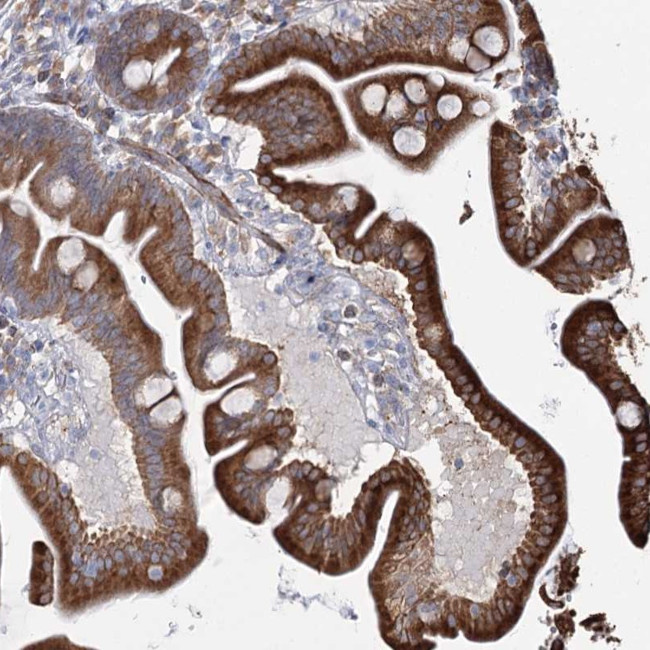 ZCCHC9 Antibody in Immunohistochemistry (Paraffin) (IHC (P))