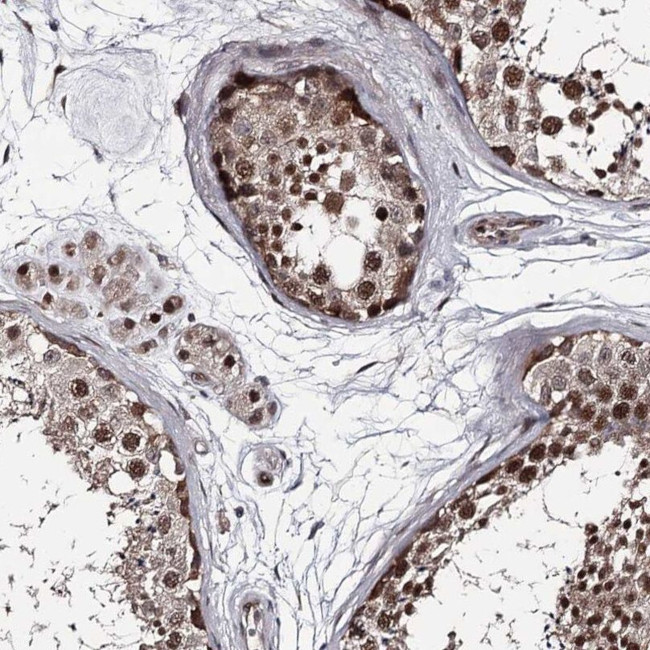 PRPF40B Antibody in Immunohistochemistry (IHC)