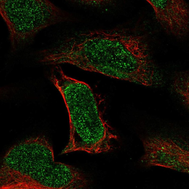 ATE1 Antibody in Immunocytochemistry (ICC/IF)