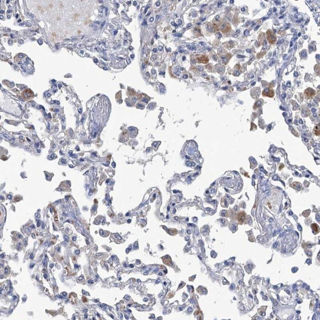 RTKN2 Antibody in Immunohistochemistry (IHC)