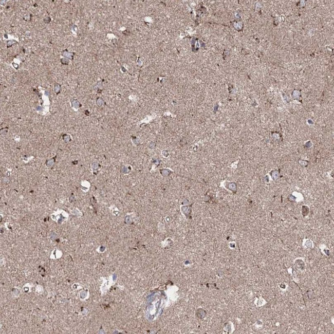 ARHGAP20 Antibody in Immunohistochemistry (IHC)
