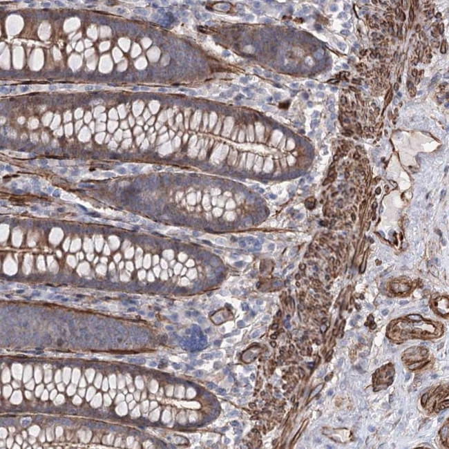 ARHGAP20 Antibody in Immunohistochemistry (Paraffin) (IHC (P))