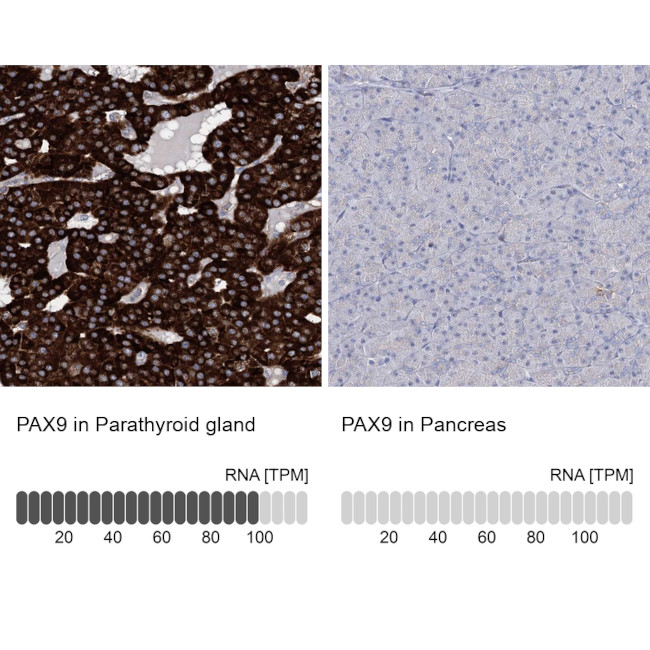 PAX9 Antibody