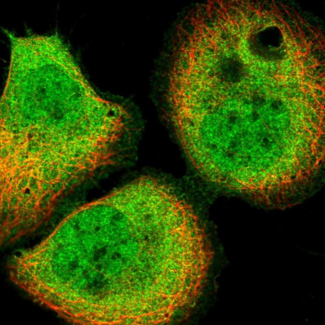 PPP6R3 Antibody in Immunocytochemistry (ICC/IF)