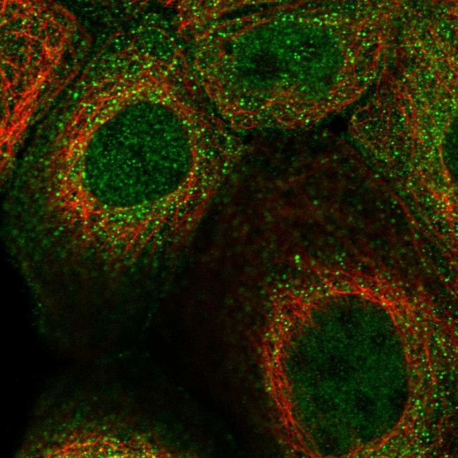SNX22 Antibody in Immunocytochemistry (ICC/IF)