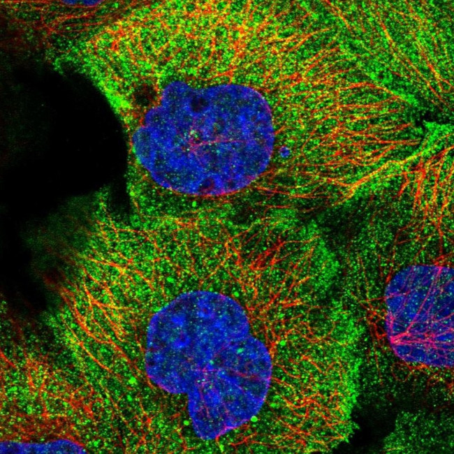 TMEM218 Antibody in Immunocytochemistry (ICC/IF)