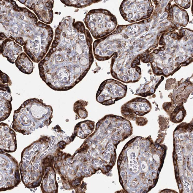 NHLRC2 Antibody in Immunohistochemistry (Paraffin) (IHC (P))