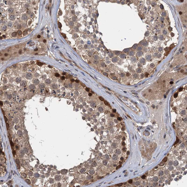 C12orf41 Antibody in Immunohistochemistry (Paraffin) (IHC (P))